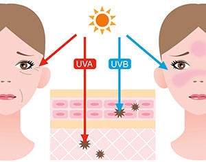 UV